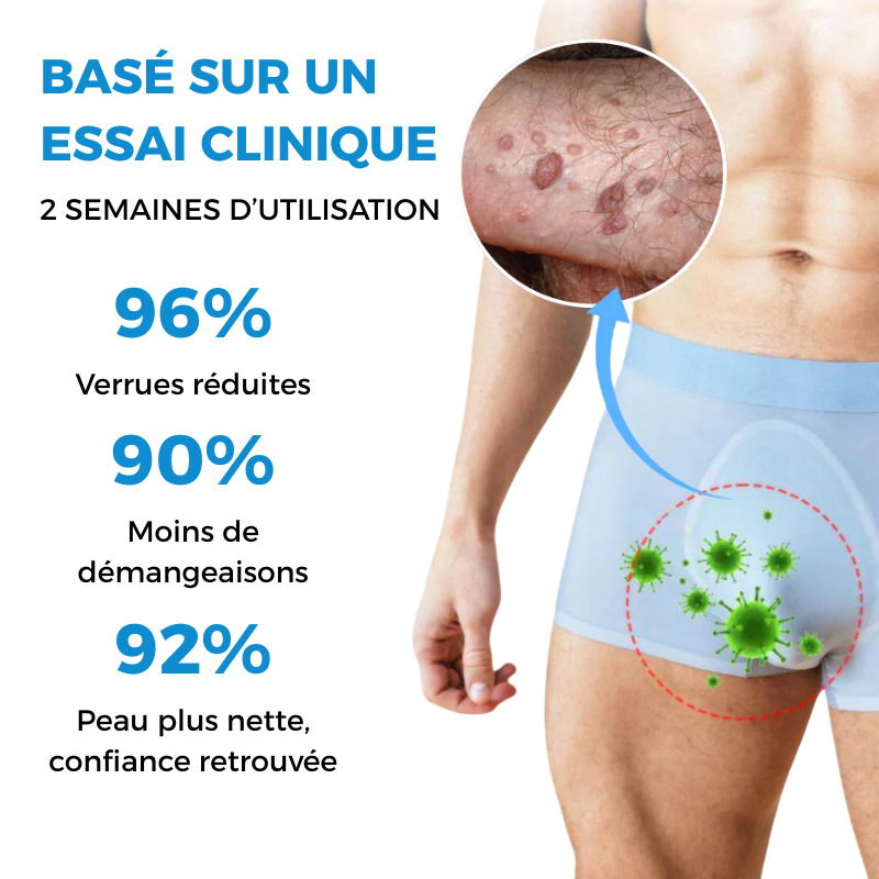 Crème Éliminatrice de Verrues Génitales