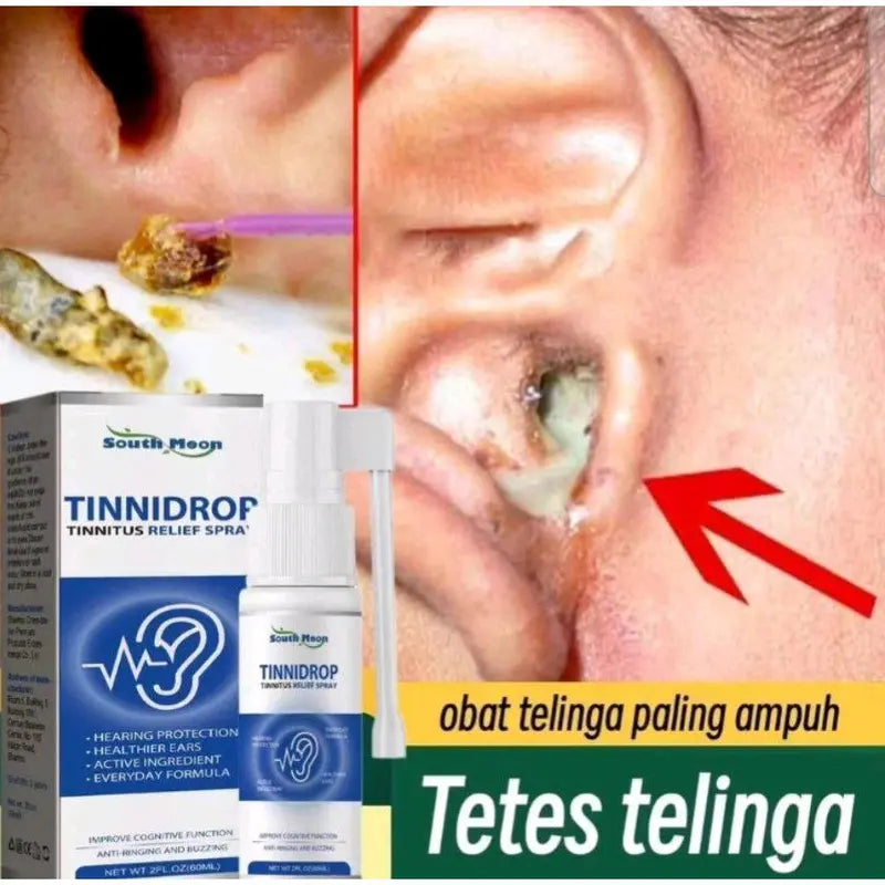 Spray anti-acouphènes Tinnidrop 🌿 (1 acheté, 1 offert 🔥🔥) (BJ)