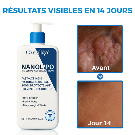 Crème Éliminatrice de Verrues Génitales