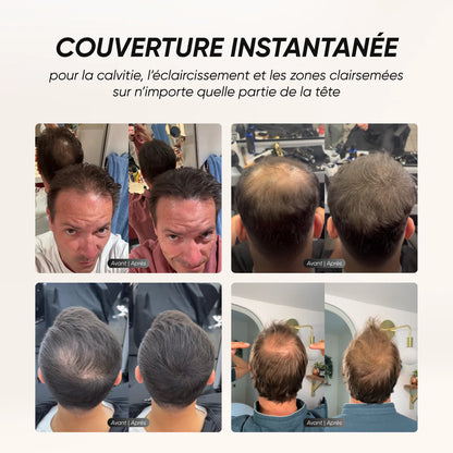 ⭐ NAMILKA – Le Camouflage Capillaire qui Transforme Votre Confiance (gn)