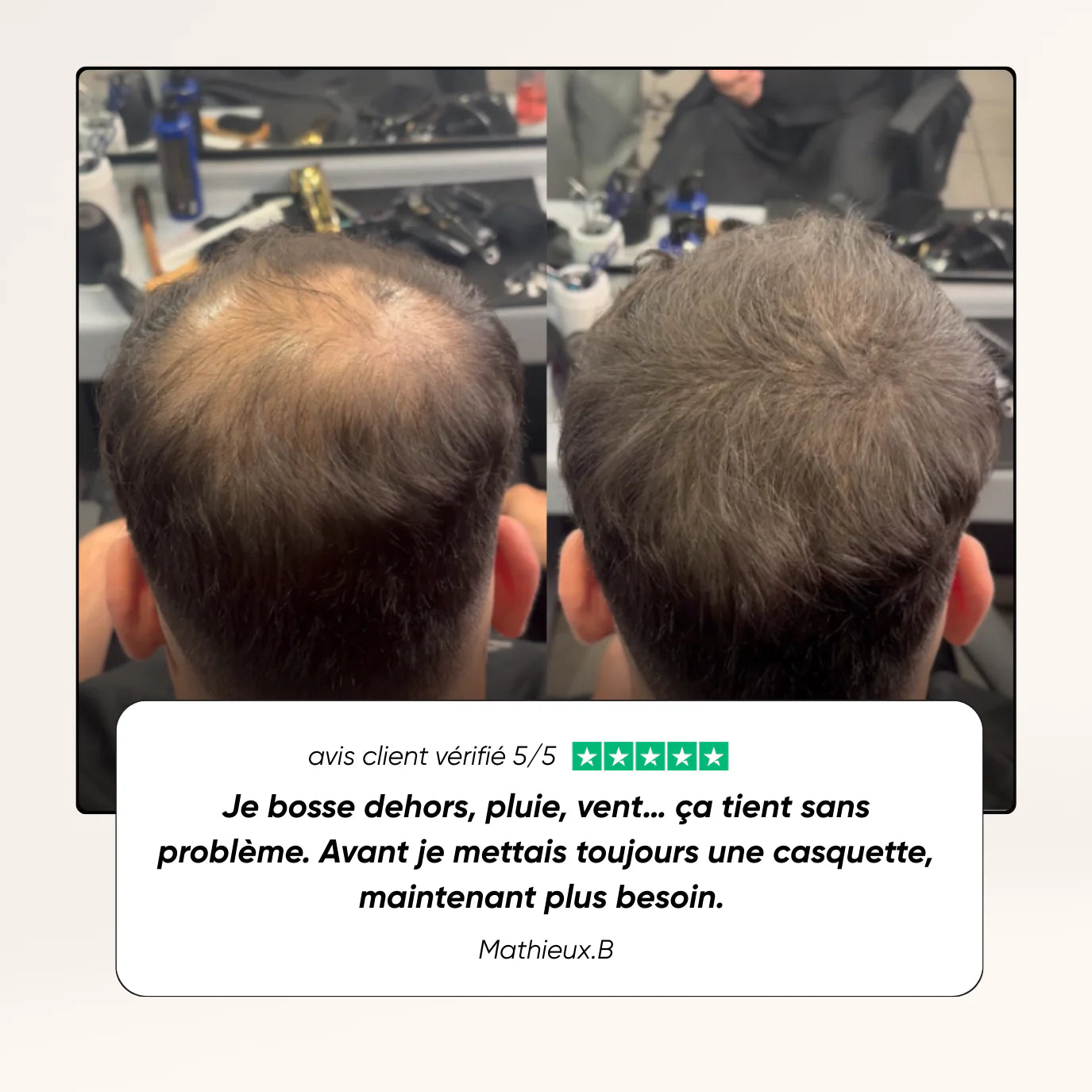 ⭐ NAMILKA – Le Camouflage Capillaire qui Transforme Votre Confiance (gn)